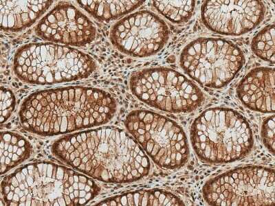 Immunohistochemistry-Paraffin: HSP70/HSPA1A [ac Lys77] Antibody [NBP2-61122]